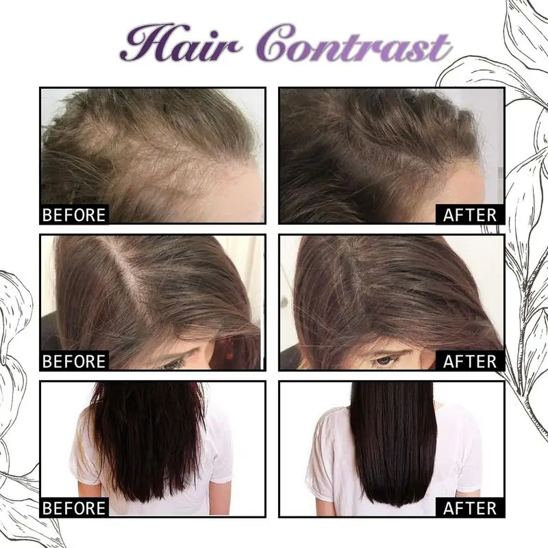 30ml Onion Rosemary Anti-Hair  - Hair Care Ordinary ulasan dan harga