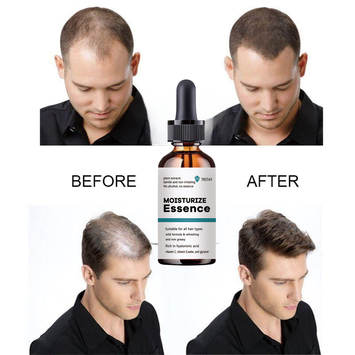2022 New Hair Growth Essence P - Hair Care Ordinary ulasan dan harga